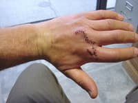 Hand Carnage, courtesy of West Gally